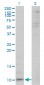 CXCL5 Antibody (monoclonal) (M03)