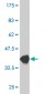 CXCL5 Antibody (monoclonal) (M05)