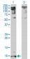 CXCL5 Antibody (monoclonal) (M05)