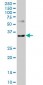 CXCR4 Antibody (monoclonal) (M04)