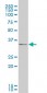 CXCR4 Antibody (monoclonal) (M04)