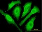 CYGB Antibody (monoclonal) (M02)