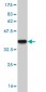 CYP24A1 Antibody (monoclonal) (M07)