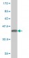 CYP2J2 Antibody (monoclonal) (M01)
