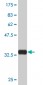 CYP7B1 Antibody (monoclonal) (M06)