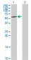 CYP7B1 Antibody (monoclonal) (M06)