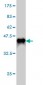 DAG1 Antibody (monoclonal) (M01)