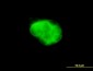 DCAKD Antibody (monoclonal) (M02)