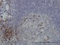 DCAKD Antibody (monoclonal) (M02)