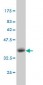 DCAKD Antibody (monoclonal) (M02)