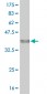 DCAMKL1 Antibody (monoclonal) (M02)