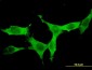 DCAMKL1 Antibody (monoclonal) (M03)