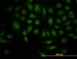 DCP1A Antibody (monoclonal) (M06)