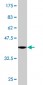 DCP1A Antibody (monoclonal) (M06)