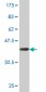 DCP1A Antibody (monoclonal) (M07)