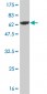 DCPS Antibody (monoclonal) (M02)