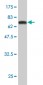 DCPS Antibody (monoclonal) (M03)