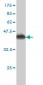 DCTN2 Antibody (monoclonal) (M01)