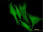 DCX Antibody (monoclonal) (M01)