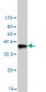 DCXR Antibody (monoclonal) (M03)