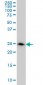 DCXR Antibody (monoclonal) (M03)
