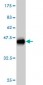 DDEF1 Antibody (monoclonal) (M01)
