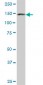 DDEF1 Antibody (monoclonal) (M01)