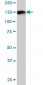 DDEF1 Antibody (monoclonal) (M01)