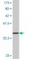 DDEF1 Antibody (monoclonal) (M02)