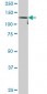DDEF1 Antibody (monoclonal) (M02)
