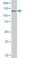DDEF1 Antibody (monoclonal) (M02)