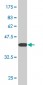 DDX1 Antibody (monoclonal) (M02)