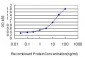 DDX20 Antibody (monoclonal) (M01)