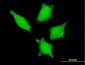 DDX20 Antibody (monoclonal) (M01)