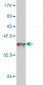 DDX41 Antibody (monoclonal) (M01)