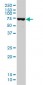 DDX41 Antibody (monoclonal) (M01)