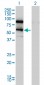 DDX41 Antibody (monoclonal) (M01)