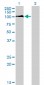 DDX54 Antibody (monoclonal) (M01)