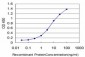 DDX54 Antibody (monoclonal) (M03)