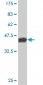 DDX54 Antibody (monoclonal) (M03)