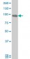 DDX54 Antibody (monoclonal) (M03)