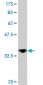 DDX56 Antibody (monoclonal) (M03)