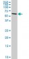 DDX56 Antibody (monoclonal) (M03)