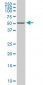 DDX56 Antibody (monoclonal) (M03)