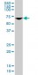 DDX56 Antibody (monoclonal) (M03)