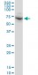 DDX56 Antibody (monoclonal) (M03)