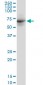 DDX56 Antibody (monoclonal) (M03)