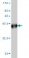 DDX56 Antibody (monoclonal) (M05)