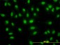 DDX56 Antibody (monoclonal) (M05)