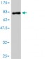 DDX6 Antibody (monoclonal) (M01)